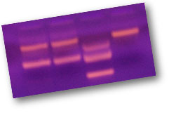 PCR para las toxinas Sta, Stb, Lt