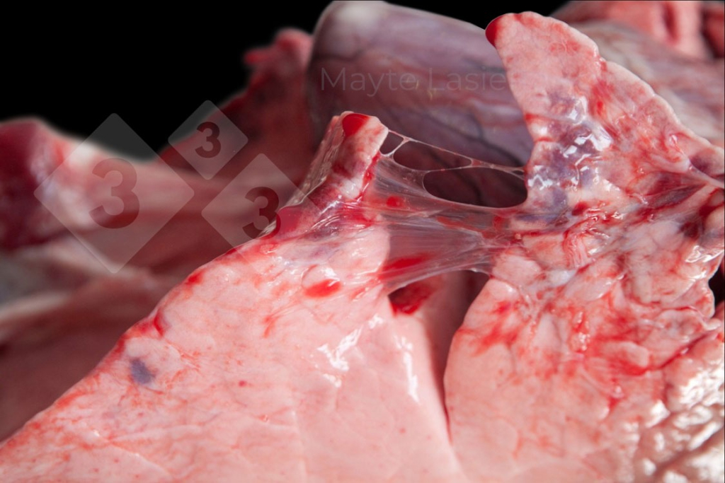 <p>Pleuritis craneal</p>