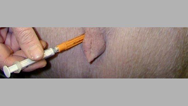 20110111-vulva