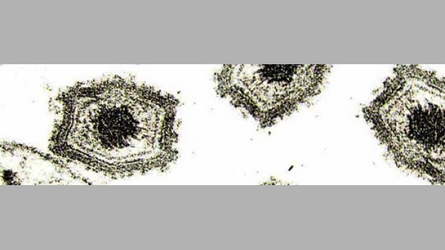 Virus de la Peste porcina africana