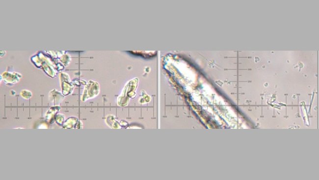 Ac. acetilsalicílico micronizado y no micronizado