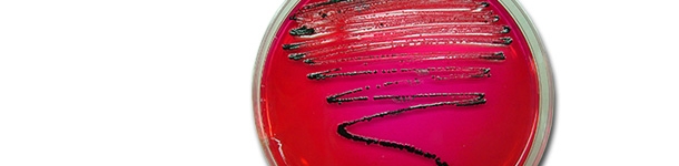 Aislamiento de Salmonella en XLD. En este medio las colonias de salmonella crecen de color negro debido a la producci&oacute;n de &aacute;cido sulfhidrico.