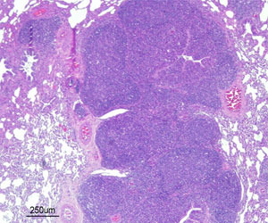 Neumonía bronco-intersticial con hiperplasia del tejido linfoide bronco-alveolar (BALT) causada por una infección experimental por Mhyo.
