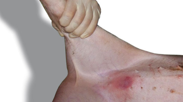 Reacción típica de eritema observada 24 h tras aplicación en la piel del abdomen