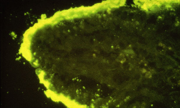 Densas colonias de E coli adheridas a una vellosidad intestinal (IFA)