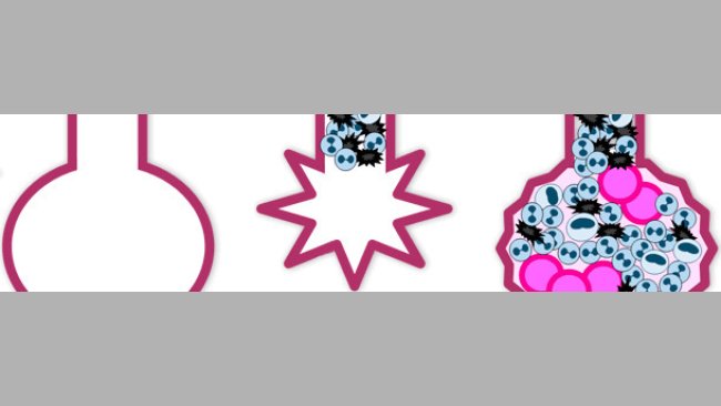 Patogenia del virus de la Influenza porcina