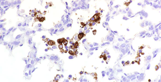 Figura 1. Antígeno de PRRSV detectado en tejido.