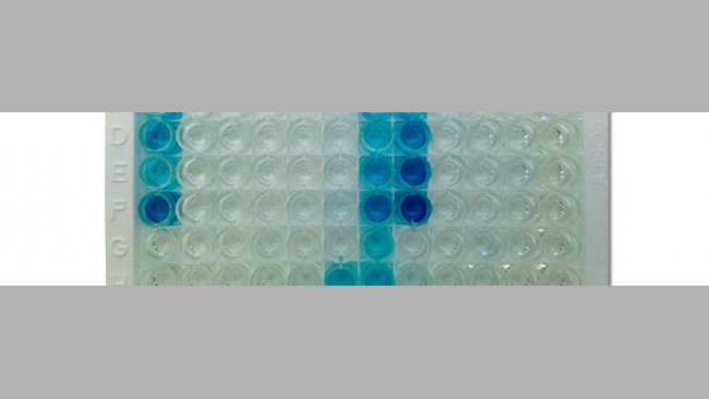Fotografía de una placa IDEXX ELISA X3 que muestra resultados positivos (color azul) y negativos (sin color)