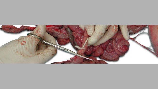 Ligar el tramo del intestino por los extremos antes de cortar.