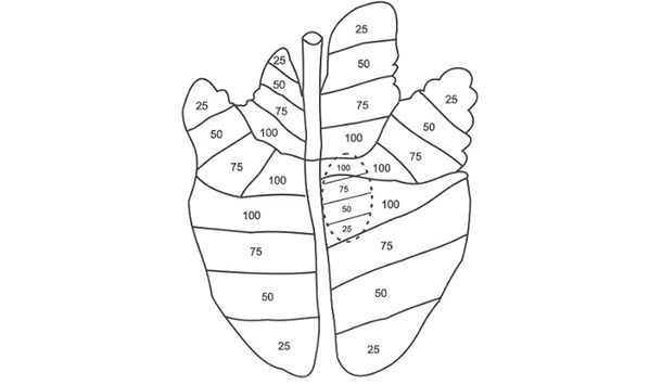 División imaginaria de los lóbulos pulmonares en cuatro partes iguales