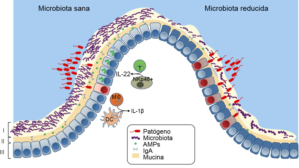 Defensas de una mucosa sana o con disbiosis