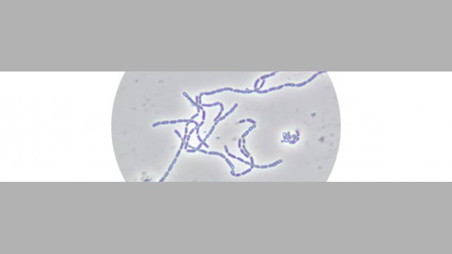 Figura 2. Lactobacillus rhamnosus CTC1679 al microscopio óptico de contraste de fases