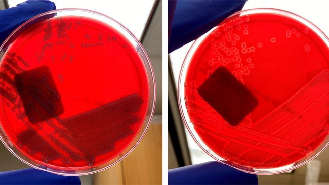 E. coli no hemolítica (izquierda) y E. coli hemolítica (derecha)