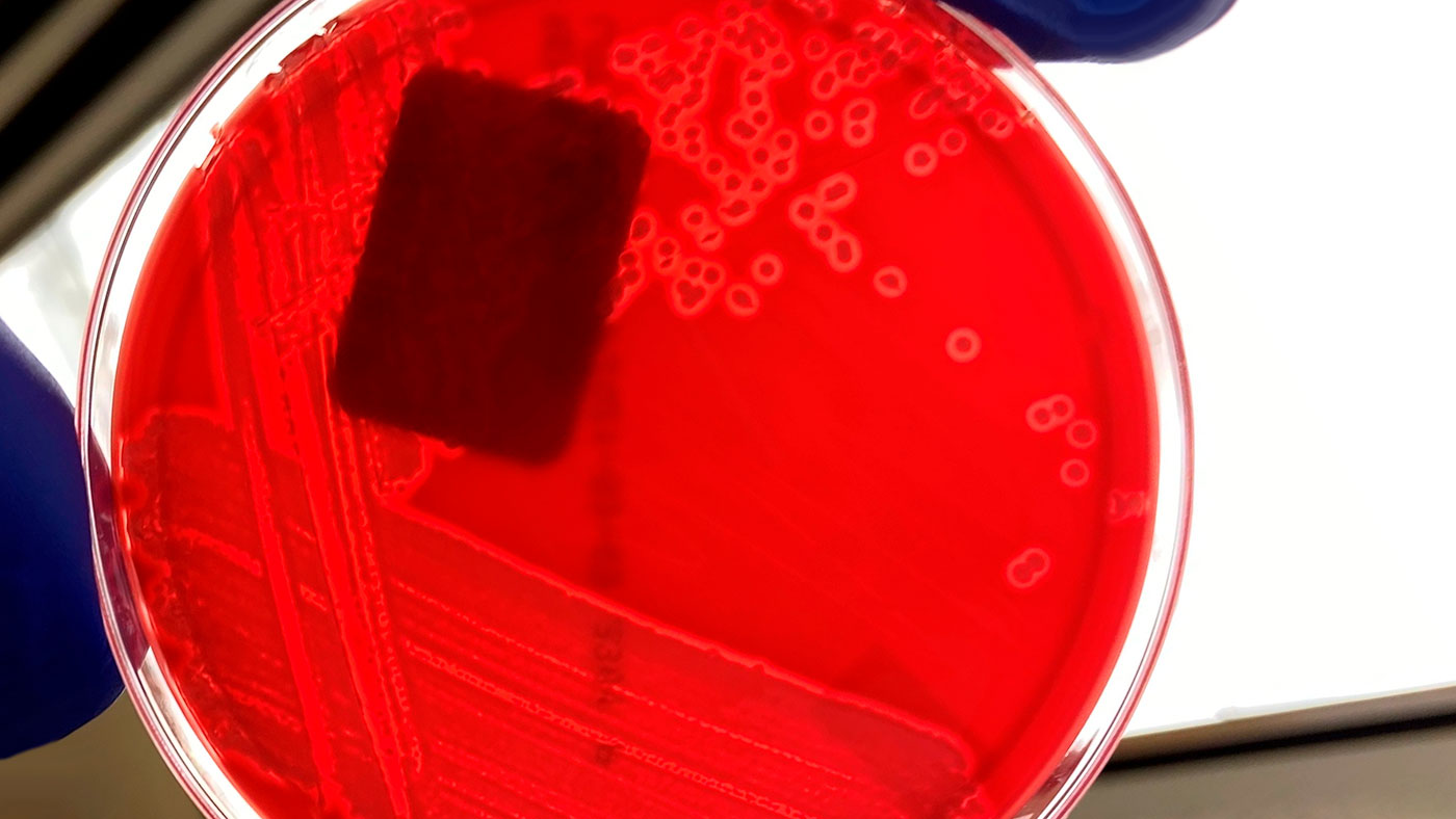 <p>Figura 1. Cultivo puro de <em>E. coli</em> hemol&iacute;tica en agar sangre.&nbsp;La zona clara alrededor de cada colonia bacteriana indica hem&oacute;lisis (descomposici&oacute;n de la sangre en placa de agar). Fuente: Universidad Estatal de Iowa, Laboratorio de Diagn&oacute;stico Veterinario, Secci&oacute;n de Bacteriolog&iacute;a.</p>
