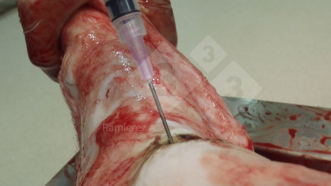 Figura 1. Recogida de muestra de líquido articular en un cerdo muerto. Se elimina la piel y se usa una jeringa para recoger el líquido articular de forma aséptica.
