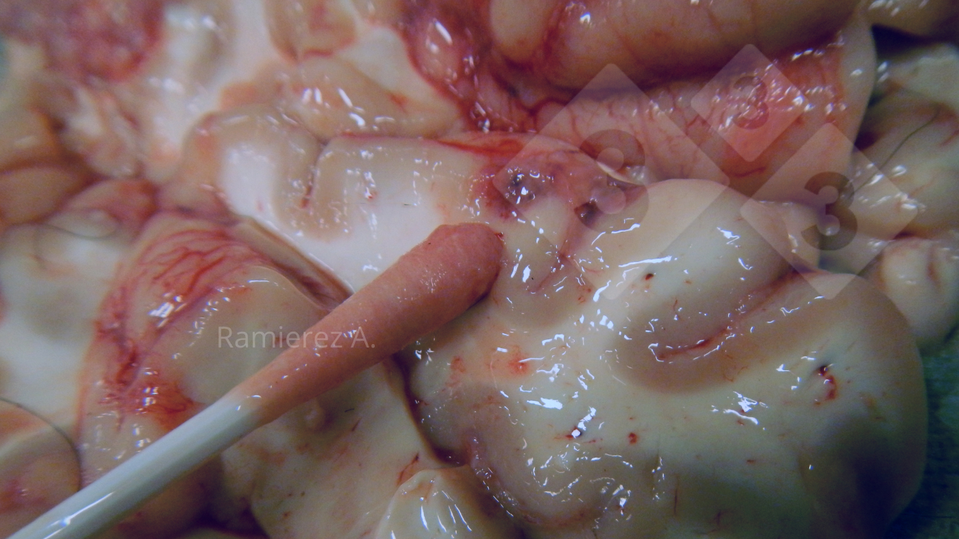 <p>Figura 3.&nbsp;Recogida de muestra de la superficie ventral del cerebro con un hisopo.</p>
