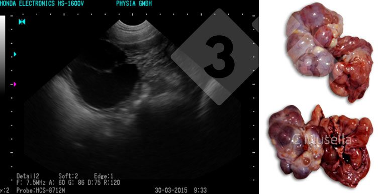 <p>Figura 3. Ovarios poliqu&iacute;sticos.</p>
