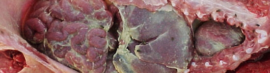 Presencia de fibrina