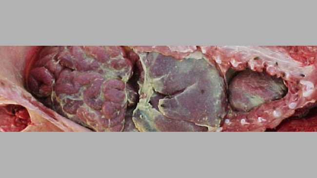 Presencia de fibrina