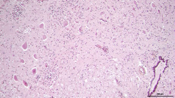 Análisis histológico