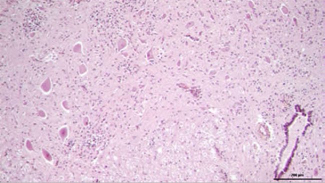 Análisis histológico