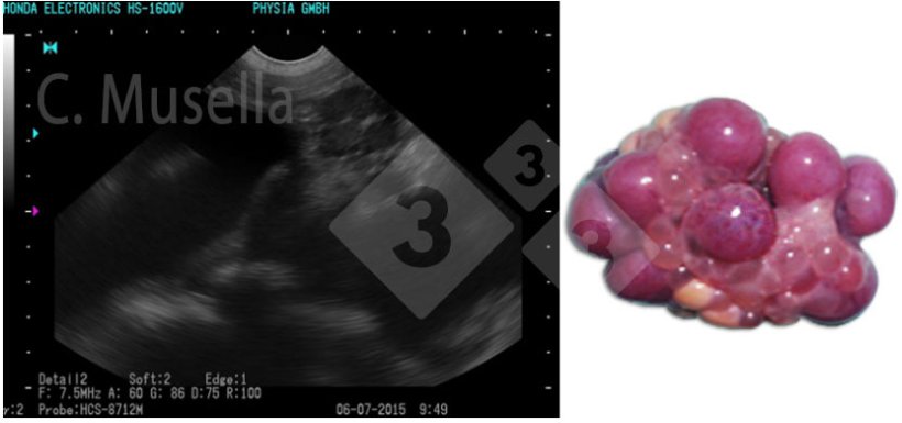 Figura 1. Corpo&nbsp;l&uacute;teo.
