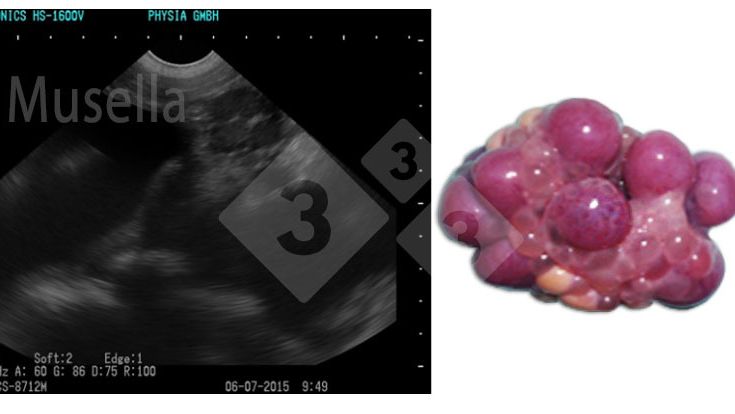 Figura 1. Corpo&nbsp;l&uacute;teo.
