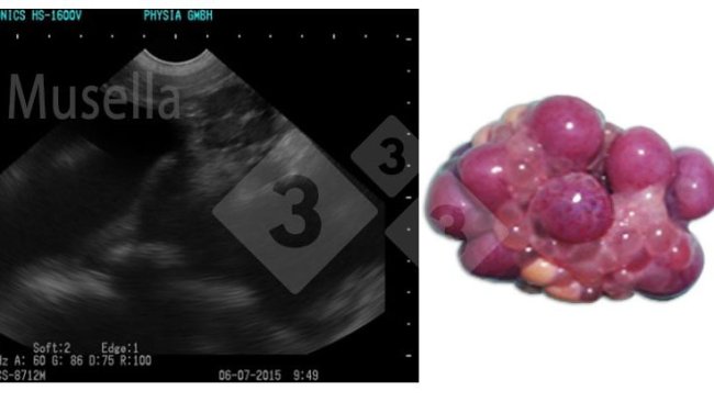 Figura 1. Corpo lúteo.