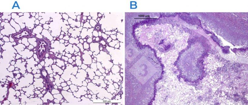 Figura 2. Colora&ccedil;&atilde;o de hematoxilina-eosina em pulm&atilde;o normal (A) e afetado (B). O pulm&atilde;o em B &eacute; afetado por pleuropneumonia fibrinonecrosante causada por Actinobacillus pleuropneumoniae.
