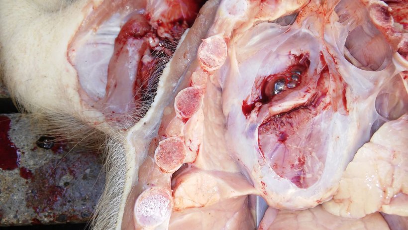 Figura 5. Pericarditis.
