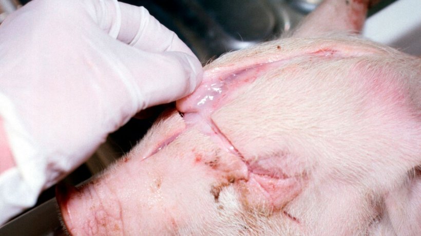 Figure 3. Subcutaneous oedema.