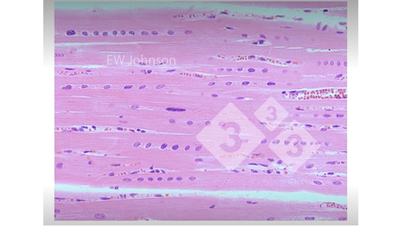 Figure 3: Heart muscle with haemorrhage, hyaline necrosis, and rowing of the nucleus showing vitamin E and selenium deficiency. These pigs would not have a normally functioning immune system.
