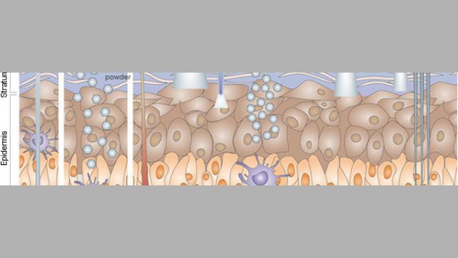 Immunisierung durch die Haut.