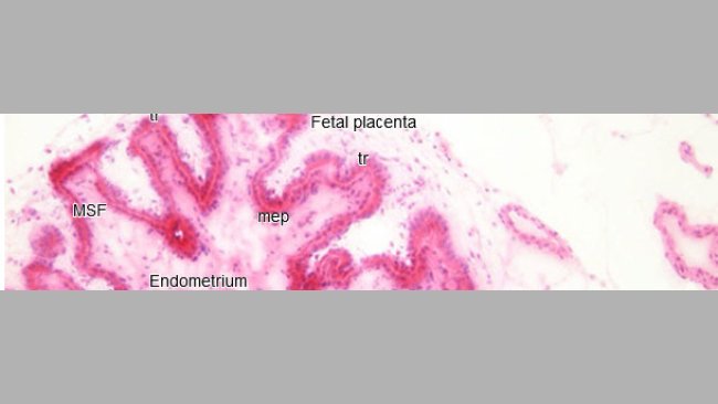 Histopathologische Untersuchung des Endometriums und der Plazenta