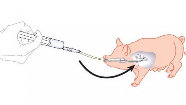 Abbildung 1: Schaubild, das eine bronchoalveoläre Lavage und einen Bronchialabstrich zeigt
