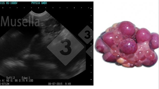 Abbildung 1: Gelbkörper