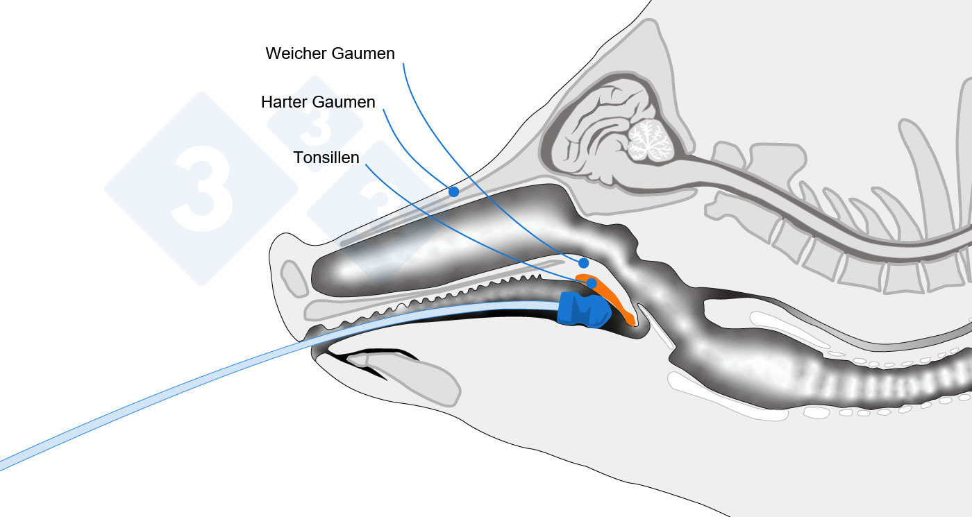 <p>Anatomische Darstellung der Probenahmestelle</p>
