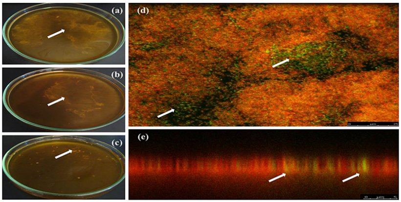 Formazione di biofilm da campioni positivi per A. pleuropneumoniae dall'acqua potabile. (a&ndash;c) Biofilm nell'interfaccia liquido-aria formati in vitro dall'acqua potabile di una fattoria messicana in tre diversi campioni (le frecce mostrano i biofilm). (d,e) tecnica FISH per rilevare A. pleuropneumoniae in biofilm da campioni di acqua potabile da allevamenti di suini; A. pleuropneumoniae &egrave; stato rilevato con sonde etichettate con fluoresceina (verde) e altri batteri sono stati etichettati con bromuro di etidio (rosso) (le frecce mostrano l'etichetta di A. pleuropneumoniae). (a,d,e) Ags5-I, (b) Ags5-II e (c) Ags5-III.
