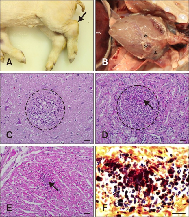 Caso 1. Reperti grossolani e istopatologici. (A) suinetto. Notare l'articolazione tarsale aumentata di volume&nbsp;(freccia). (B) Cavit&agrave; toracica. Materiali giallastri (asterischi) erano attaccati all'epicardio. (C) Cervello. &Egrave; stata osservata encefalite suppurativa con microascessi multifocali (cerchio). Colorazione di ematossilina ed eosina (H&amp;E). 400&times;. (D) Rene. Notare i microascessi multifocali (cerchio) con batteri intralesionali (freccia). Macchia H&amp;E. 400&times;. (E) Cuore. Notare i microascessi multifocali con batteri intralesionali (freccia). Macchia H&amp;E. 400&times;. (F) Cuore. Nel miocardio sono stati osservati cocchi Gram-positivi. Colorazione di Gram. 1.000 &times;. Barre della scala = 20 &micro;m (C&ndash;F).
