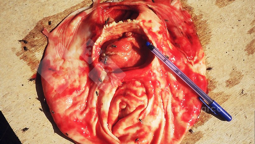 Foto 1. Ulcera gastrica avanzata
