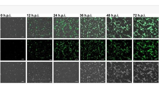 Le infezioni da virus della sindrome riproduttiva e respiratoria suina (PRRSV) a una molteplicità di infezione (MOI) di 10 sono state valutate utilizzando sieri positivi a 0, 12, 24, 36, 48 e 72 ore dopo l'infezione (h.p.i.) mediante test di immunofluorescenza (barra della scala = 100 μm). Le impostazioni di esposizione e contrasto erano coerenti in tutte le immagini per la comparabilità. Fonte: Front. Vet. Sci. 12:1737270. doi: 10.3389/fvets.2025.1737270