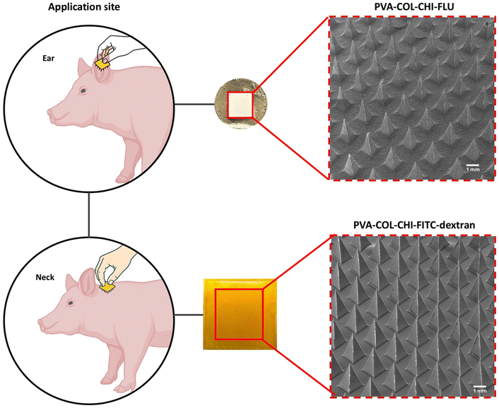 Fig. 2 Siti di applicazione e analisi morfologica dei cerotti microaghi. Immagini macroscopiche (al centro) e SEM (a destra) dei cerotti PVA&ndash;COL&ndash;CHI caricati con FLU o FITC-destrano evidenziano la geometria coerente dei microaghi.RSC Pharm., 2026, 3, 67 DOI: 10.1039/D5PM00203F