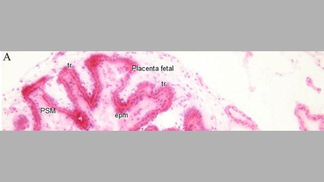 Istopatologia di endometrio e placenta
