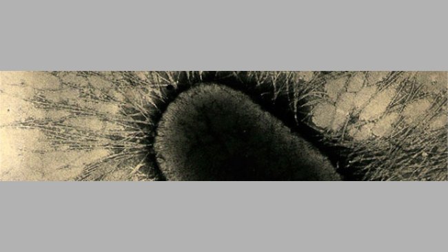 I fattori di adesione dell'ETEC sono proteine specializzate delle fimbrie o pili, che aderiscono saldamente ai recettori di glicoproteina delle cellule intestinali