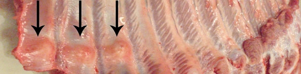 Fratture multiple distali delle costole (freccie)