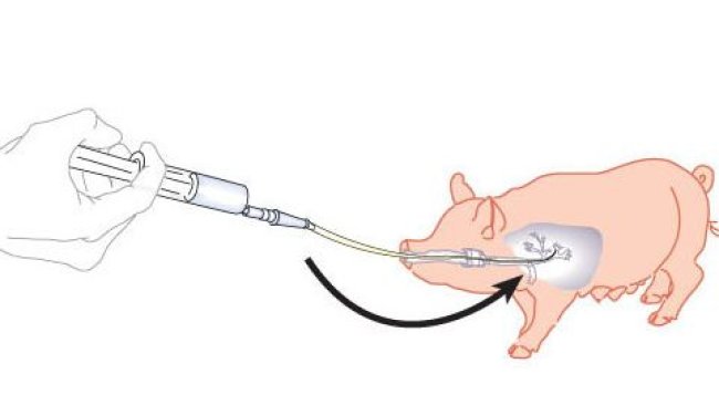 Figura 1. Schema di lavaggio broncoalveolare e raschiatura bronchiale