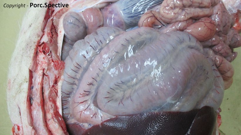 Foto 2. Edema del mesenterio del colon a spirale