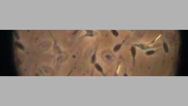 El examen del semen al microscopio