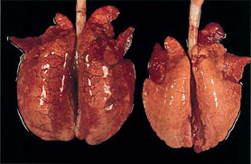 Pulmones con circovirosis porcina