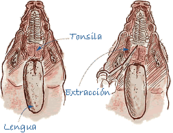 Toma de muestras de tonsila 